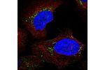Immunofluorescent staining of human cell line U-2 OS shows localization to vesicles.