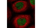 Immunofluorescent staining of human cell line A-431 shows localization to nucleoplasm & nuclear bodies.