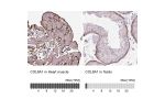 Immunohistochemistry analysis in human lung and cerebral cortex tissues using Anti-COL8A1 antibody. Corresponding COL8A1 RNA-seq data are presented for the same tissues.