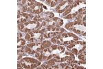 Immunohistochemical staining of human stomach, upper shows strong granular cytoplasmic positivity in glandular cells.