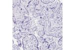 Immunohistochemical staining of human placenta shows no positivity in trophoblastic cells as expected.