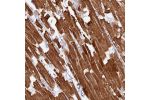 Immunohistochemical staining of human heart muscle shows moderate to strong cytoplasmic positivity in cardiomyocytes.