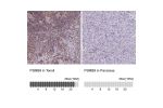 Immunohistochemistry analysis in human lymph node and kidney tissues using Anti-PSMB9 antibody. Corresponding PSMB9 RNA-seq data are presented for the same tissues.