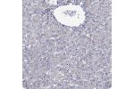 Immunohistochemical staining of human liver shows weak to moderate membranous positivity in bile duct cells.