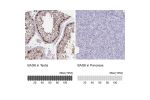 Immunohistochemistry analysis in human testis and pancreas tissues using HPA053291 antibody. Corresponding BAG6 RNA-seq data are presented for the same tissues.