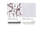 Immunohistochemistry analysis in human bone marrow and skeletal muscle tissues using HPA053314 antibody. Corresponding HMGB2 RNA-seq data are presented for the same tissues.
