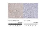 Immunohistochemistry analysis in human cerebral cortex and liver tissues using HPA053342 antibody. Corresponding PDYN RNA-seq data are presented for the same tissues.