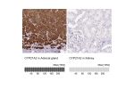 Immunohistochemistry analysis in human adrenal gland and kidney tissues using HPA053371 antibody. Corresponding CYP21A2 RNA-seq data are presented for the same tissues.