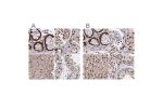 Immunohistochemical staining of human colon, kidney, liver and testis using Anti-HDGF antibody HPA053422 (A) shows similar protein distribution across tissues to independent antibody HPA048728 (B).
