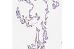 Immunohistochemical staining of human lung shows strong membranous positivity in macrophages.