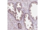 Immunohistochemical staining of human rectum shows strong cytoplasmic positivity in glandular cells.