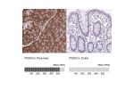 Immunohistochemistry analysis in human pancreas and colon tissues using Anti-PDIA2 antibody. Corresponding PDIA2 RNA-seq data are presented for the same tissues.