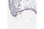 Immunohistochemical staining of human bronchus shows moderate nuclear membranous positivity in respiratory epithelial cells.