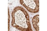 Immunohistochemical staining of human testis shows strong cytoplasmic positivity in cells in seminiferus ducts.