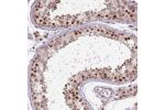 Immunohistochemical staining of human testis shows strong nuclear positivity in cells in seminiferous ducts.
