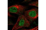 Immunofluorescent staining of human cell line U-2 OS shows localization to nucleoplasm.