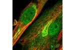 Immunofluorescent staining of human cell line BJ shows localization to nucleoplasm, the Golgi apparatus & actin filaments.