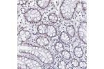 Immunohistochemical staining of human colon shows strong nucleoli positivity in glandular cells.
