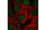 Immunofluorescent staining of human cell line MCF7 shows localization to nucleoplasm.