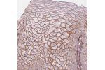 Immunohistochemical staining of human cervix, uterine shows strong membranous positivity in squamous epithelial cells.