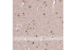 Immunohistochemical staining of human cerebral cortex shows strong cytoplasmic positivity in neuronal cells.