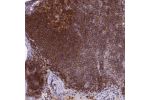 Immunohistochemical staining of human lymphoid tissues shows strong cytoplasmic positivity in germinal and non-germinal cells.