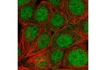 Immunofluorescent staining of human cell line MCF7 shows localization to nucleus & cytosol.