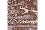 Immunohistochemical staining of human colon shows strong cytoplasmic and membranous positivity in glandular cells.