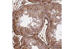 Immunohistochemical staining of human testis shows strong membranous and cytoplasmic positivity in cells in seminiferus ducts and Leydig cells.