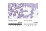 Immunohistochemistry analysis in human placenta and prostate tissues using HPA053793 antibody. Corresponding MEOX2 RNA-seq data are presented for the same tissues.
