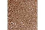 Immunohistochemical staining of human liver shows strong cytoplasmic and nuclear positivity in hepatocytes.