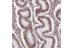 Immunohistochemical staining of human endometrium shows strong nuclear positivity in glandular cells.