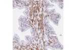 Immunohistochemical staining of human prostate shows strong cytoplasmic/ membranous positivity in smooth muscle cells.