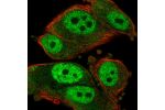 Immunofluorescent staining of human cell line PC-3 shows localization to nucleoplasm & cytosol.
