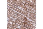 Immunohistochemical staining of human Heart muscle shows strong granular cytoplasmic positivity in cardiomyocytes.
