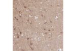 Immunohistochemical staining of human hippocampus shows strong cytoplasmic positivity in neuronal cells.
