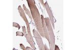 Immunohistochemical staining of human skeletal muscle shows moderate cytoplasmic positivity in myocytes.