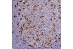 Immunohistochemical staining of human tonsil shows moderate to strong cytoplasmic positivity in dendritic cells.