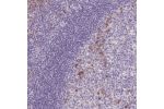 Immunohistochemical staining of human tonsil shows moderate cytoplasmic positivity in subsets of cells.