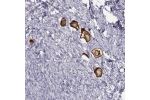 Immunohistochemical staining of human ovary shows strong membranous and cytoplasmic positivity in oocyte.