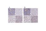 Immunohistochemical staining of human endometrium, heart muscle, kidney and pancreas using Anti-NONO antibody HPA054094 (A) shows similar protein distribution across tissues to independent antibody HPA054559 (B).