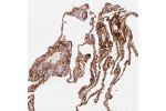 Immunohistochemical staining of human lung shows moderate extracellular space positivity in pneumocytes and macrophages.