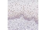 Immunohistochemical staining of human uterine cervix shows moderate to strong nuclear positivity in squamous epithelial cells.