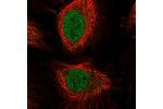 Immunofluorescent staining of human cell line HeLa shows localization to nucleoplasm.