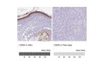Immunohistochemistry analysis in human skin and pancreas tissues using HPA054184 antibody. Corresponding CDSN RNA-seq data are presented for the same tissues.