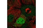 Immunofluorescent staining of human cell line CACO-2 shows localization to nucleoplasm.