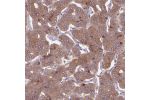 Immunohistochemical staining of human parathyroid gland shows moderate positivity in glandular cells.