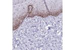 Immunohistochemical staining of human vagina shows moderate cytoplasmic and nuclear membranous positivity in squamous epithelial cells.
