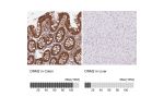Immunohistochemistry analysis in human colon and liver tissues using HPA054246 antibody. Corresponding DNM2 RNA-seq data are presented for the same tissues.