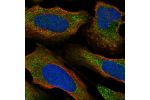 Immunofluorescent staining of human cell line U-2 OS shows localization to vesicles.
